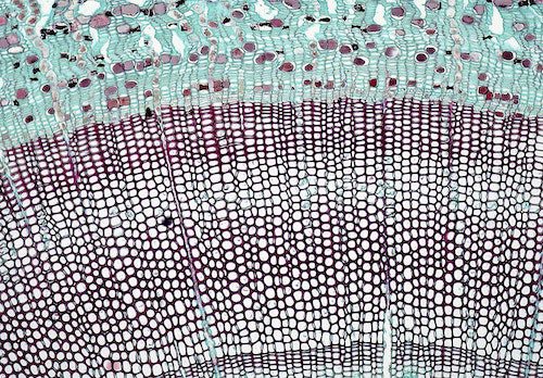 NEWS RELEASE – AUGUST 23RD, 2022, ESSENT BIOLOGICS RELEASES AMNION FOUNDATION’S FIRST HUMAN PRE-ECLAMPTIC PRIMARY CYTOTROPHOBLASTS AND HOFBAUER CELLS